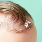 Kiedy warto wybrać się do trychologa: objawy, diagnostyka i pierwsze kroki terapii